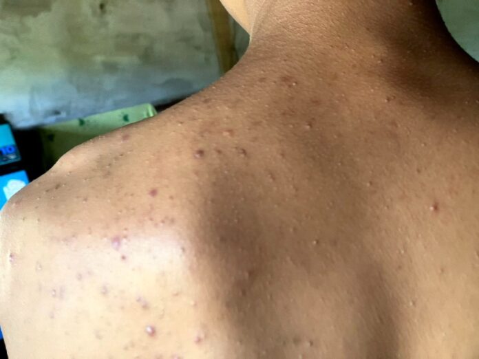 signal-2024-11-04-140717_003